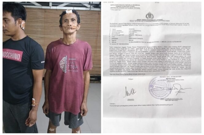 
 Dikeroyok Security, Kepling dan Acil, Korban Lapor Ke Polda Sumut Minta Pelaku Segera Ditangkap