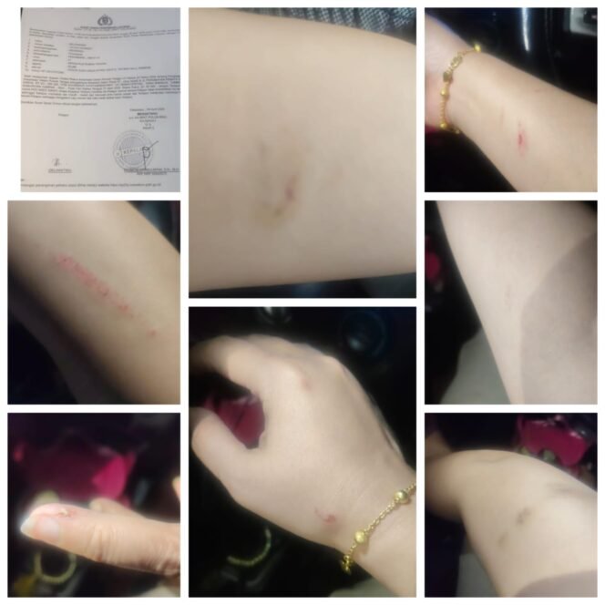 
 Dugaan KDRT di Kampar Masuk Proses Hukum, Polda Riau Terima Laporan Resmi Korban